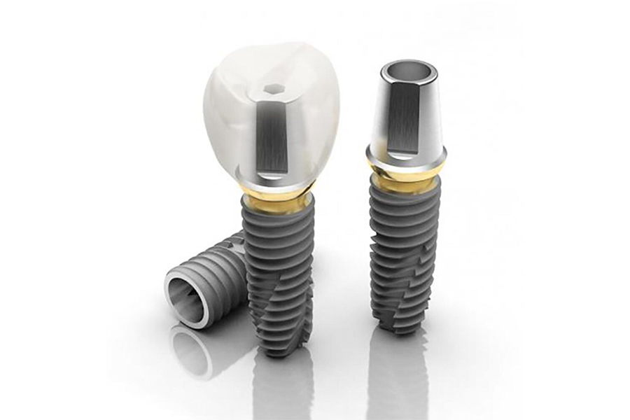 Chất Lượng Trụ Implant Không Hoàn Hảo