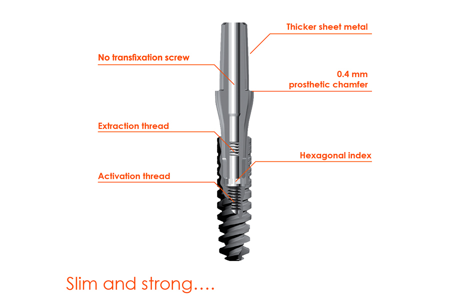 Implant Pháp