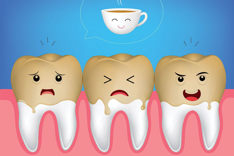 Nguyên Nhân Khiến Răng Bị Nhiễm Màu