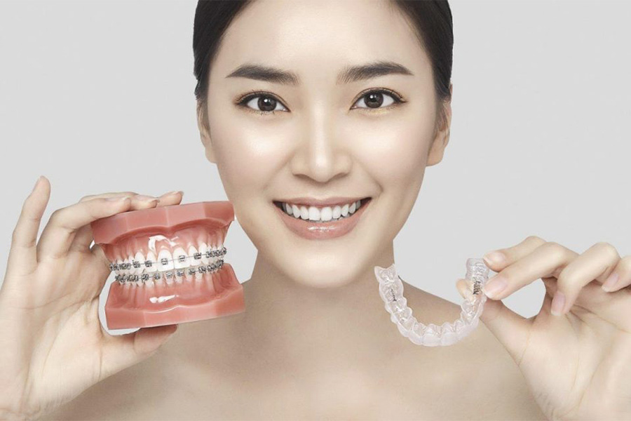 Niềng Răng Không Mắc Cài Giá Bao Nhiêu