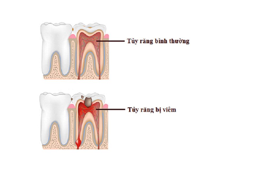 Bien Chung Viem Tuy Rang