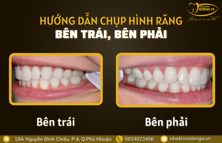 chup-hinh-rang-ben-trai-phai