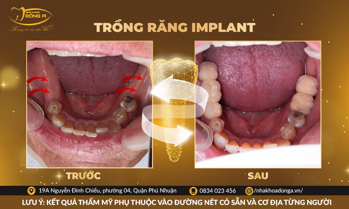 khach-hang-trong-rang-tai-dong-a