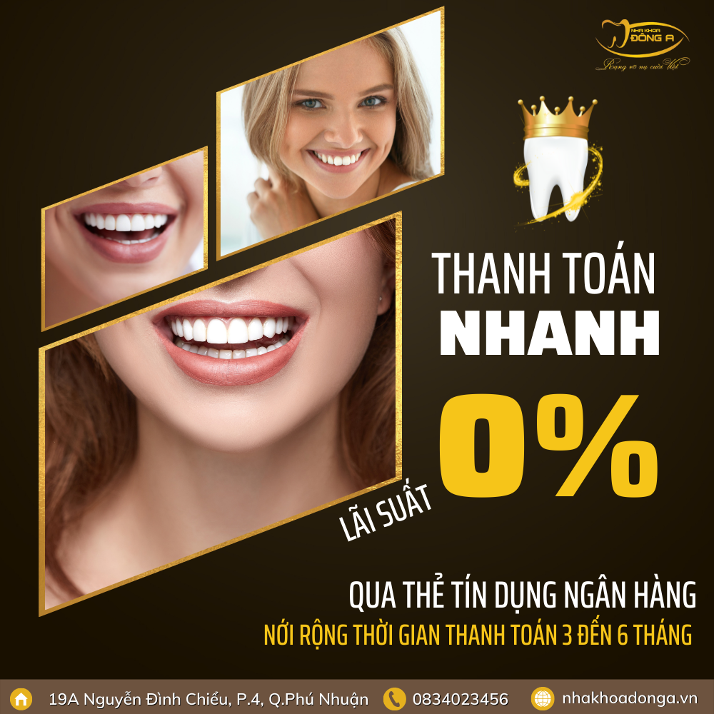 lam-rang-dep-khong-lo-chi-phi