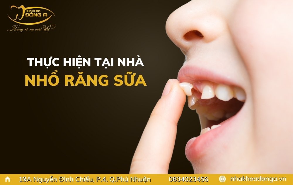 thuc-hien-nho-rang-sua-tai-nha