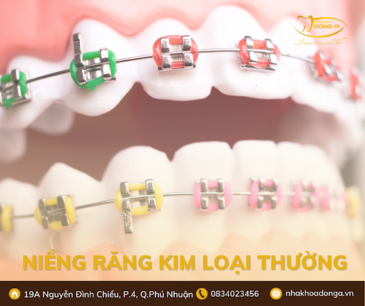 Nieng Rang Kim Loai Thuong