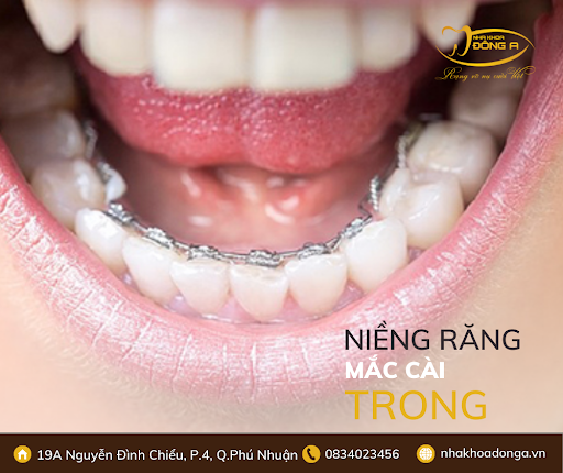 Nieng Rang Mac Cai Trong