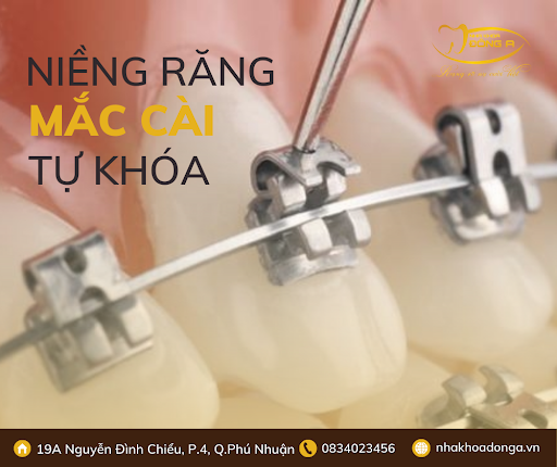 Nieng Rang Mac Cai Tu Khoa