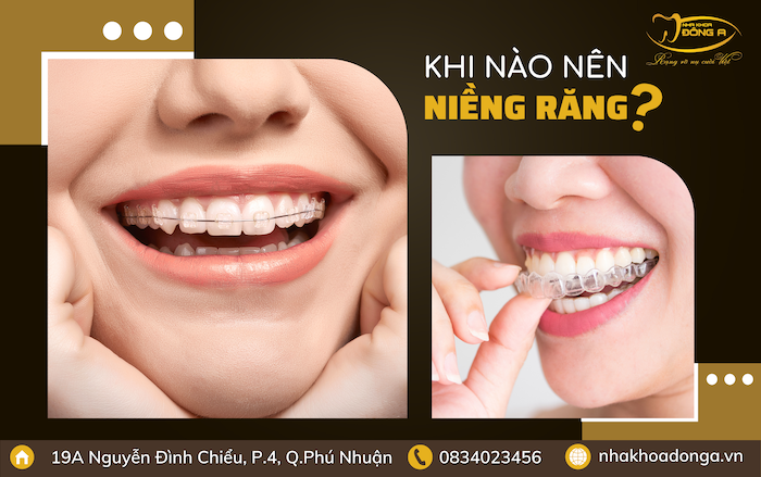 khi-nao-nen-nieng-rang