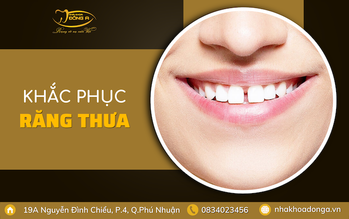 nieng-rang-khac-phuc-rang-thua