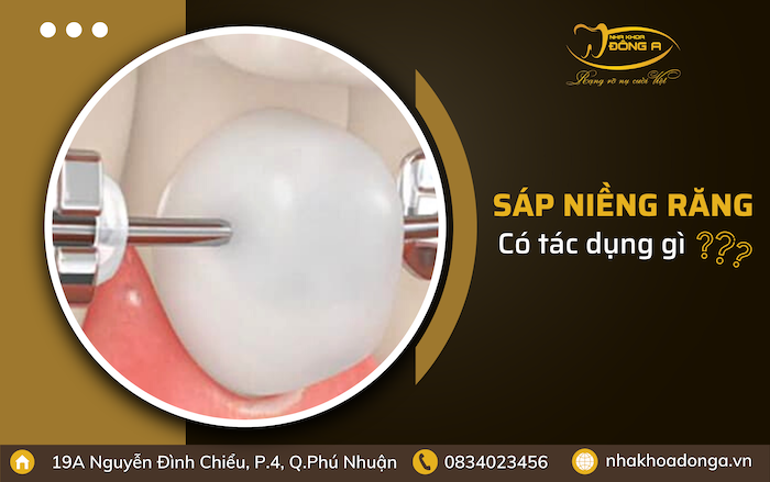tac-dung-cua-sap-nha-khoa