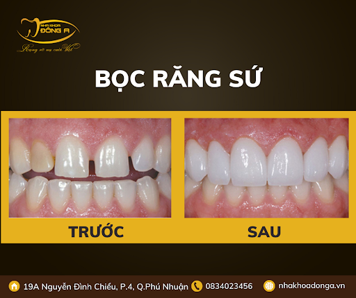 Rang Cua Thua Phai Lam Sao 2