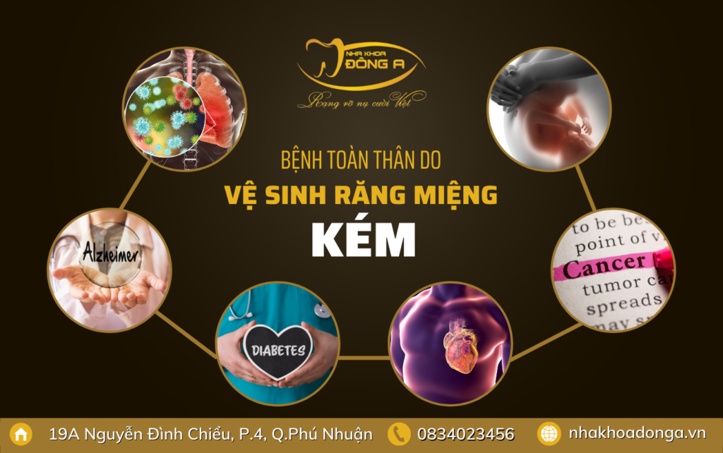 Benh Toan Than Do Ve Sinh Rang Mieng Kem