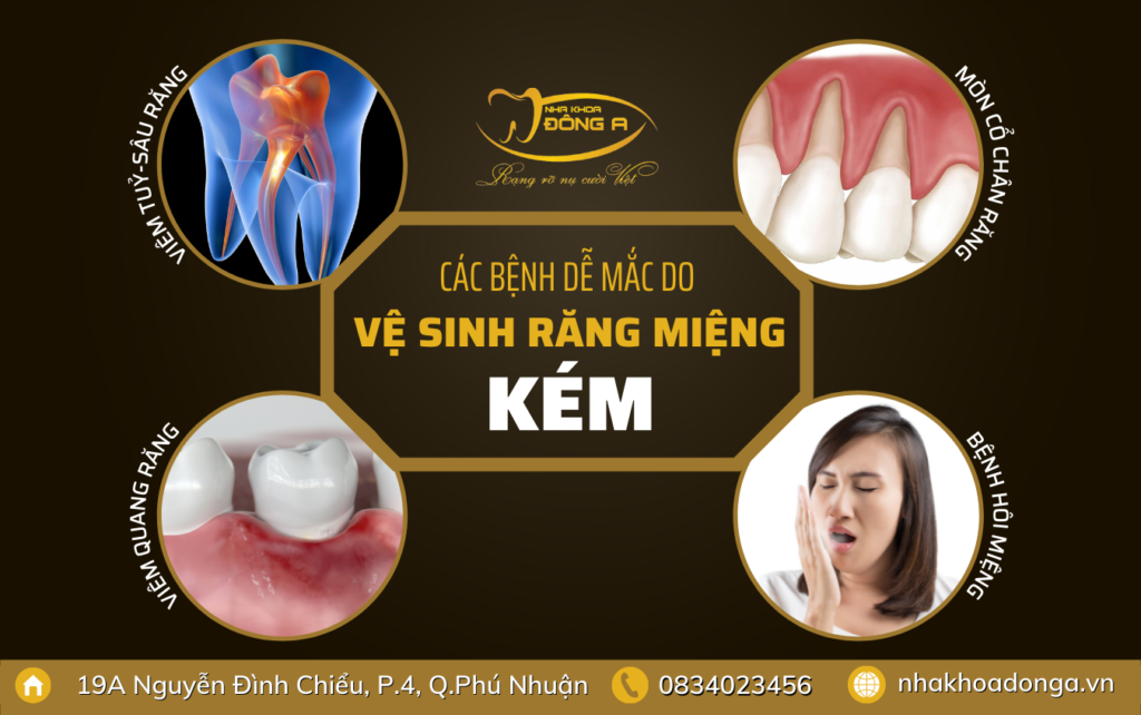 Cac Benh De Mac Do Ve Sinh Rang Mieng Kem
