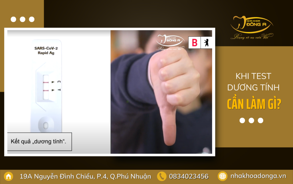 Khi Test Duong Tinh Phai Lam Gi