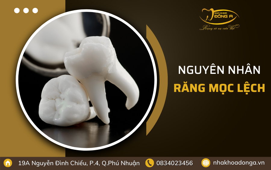 Nguyen Nhan Chay Mau Chan Rang 3