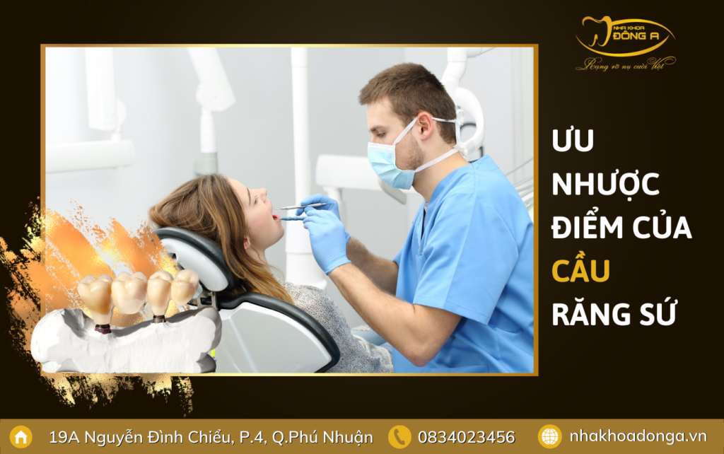 Uu Nhuoc Diem Cau Rang Su
