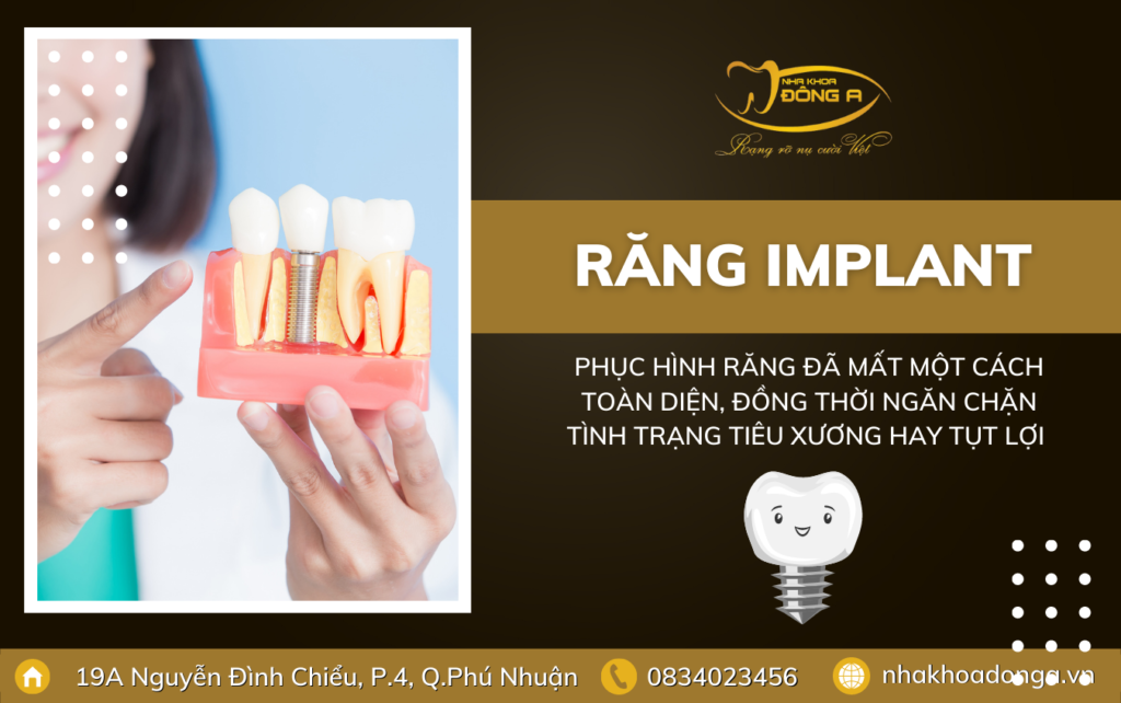 Rang Implant