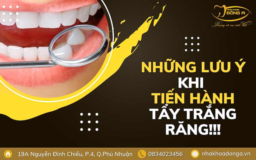 Khi Nao Nen Va Khong Nen Tay Trang Rang 2