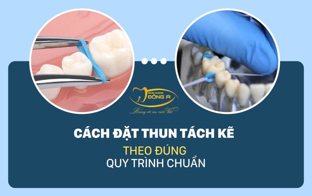 Cach Dat Thun Tach Ke Dung Chuan
