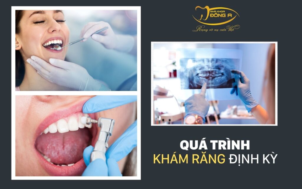 Qua Trinh Kham Rang Dinh Ky