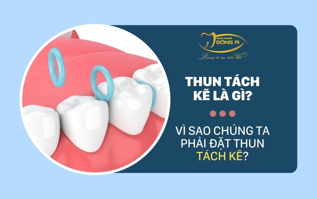 Thun Tach Ke La Gi