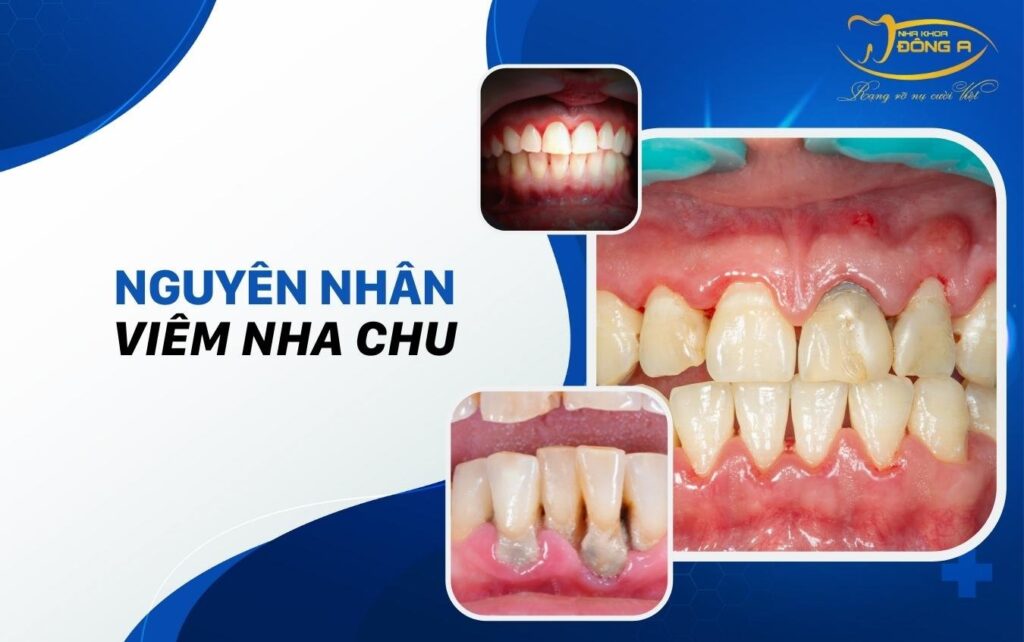 viem nha chu