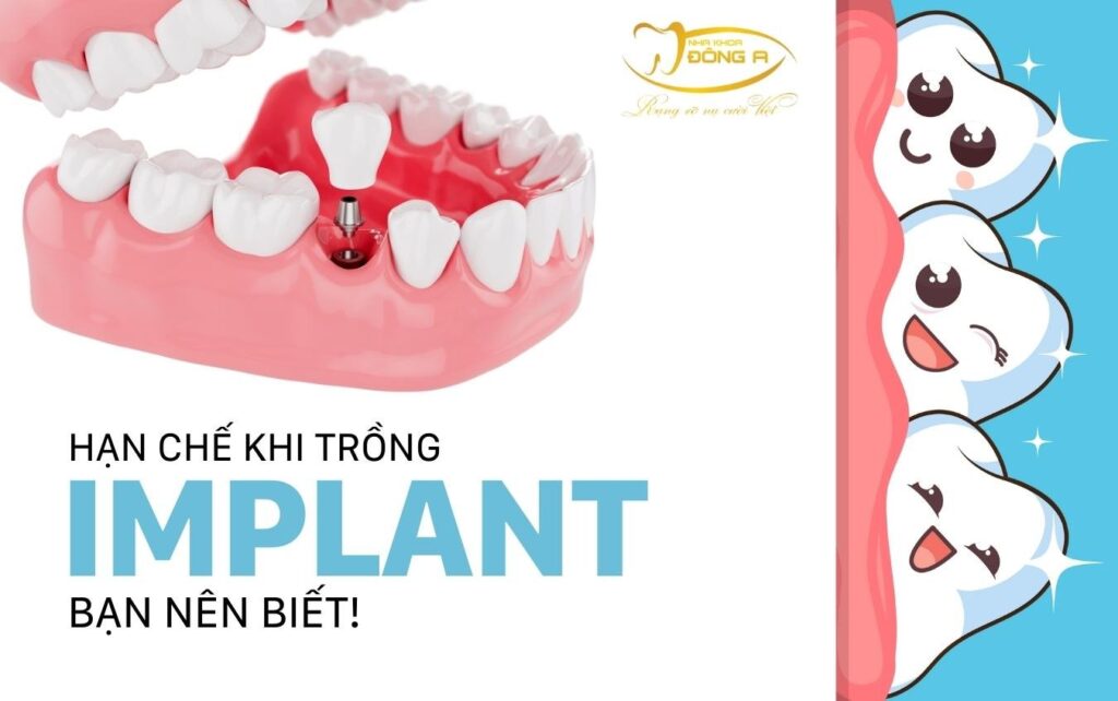 cấy implant khi chưa xét nghiệm