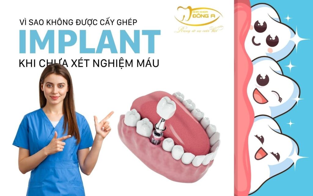 cấy implant khi chưa xét nghiệm