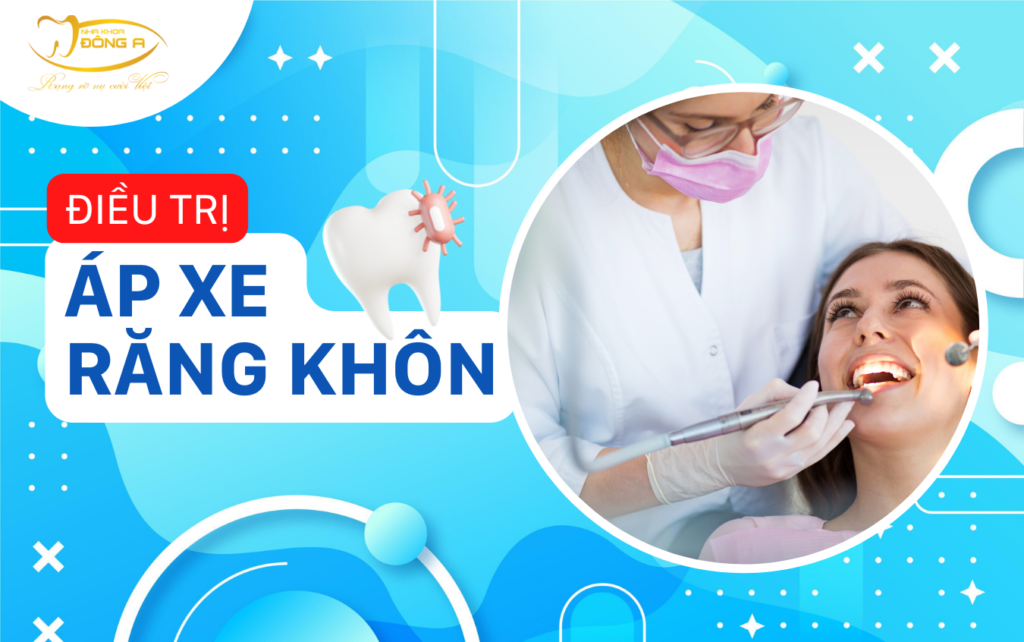 áp xe răng khôn