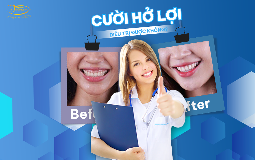 Dieu-Tri-Cuoi-Ho-Loi