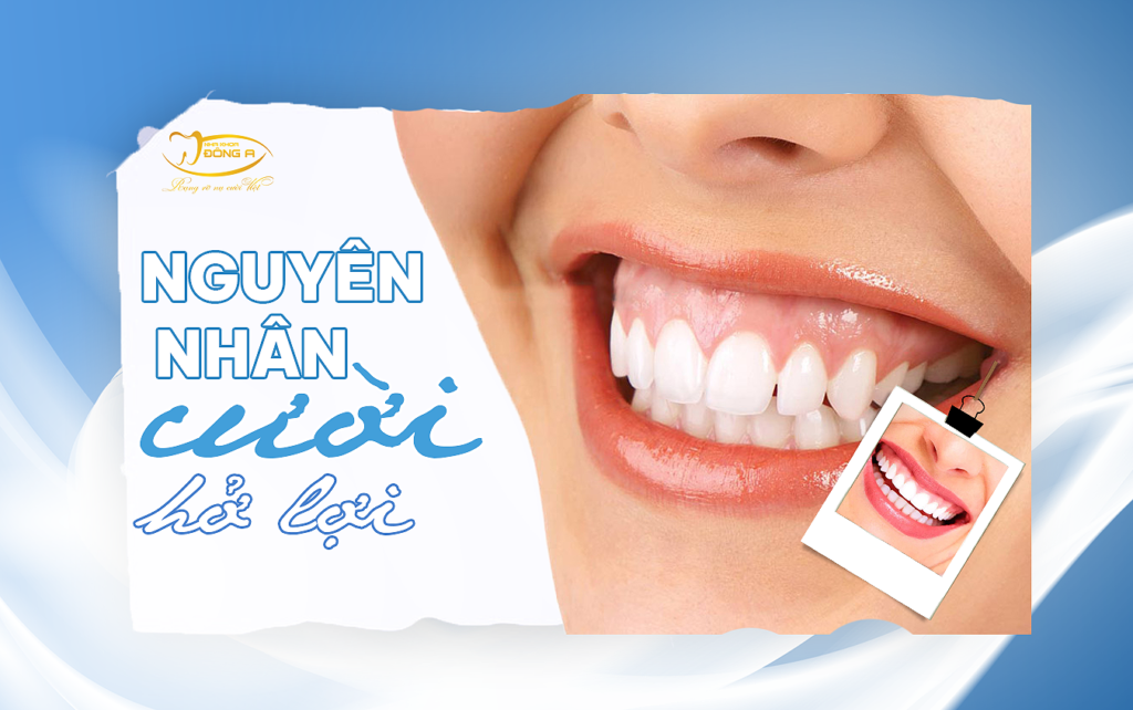 nguyen-nhan-cuoi-ho-loi