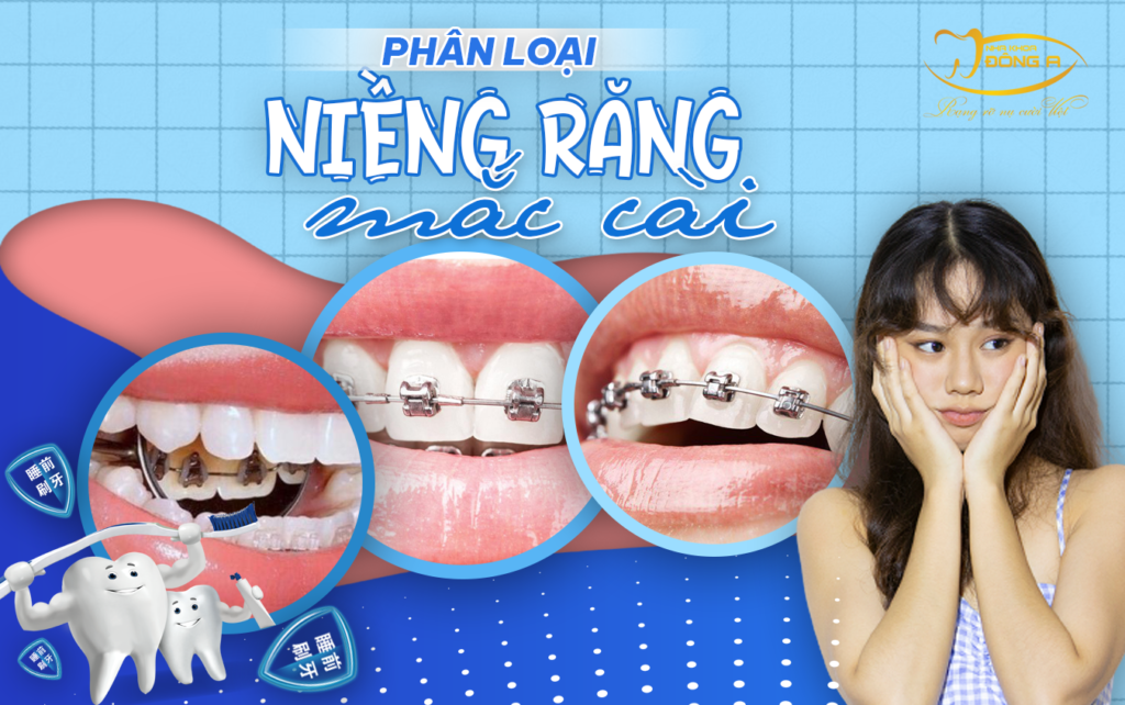nieng-rang-mac-cai-kim-loai