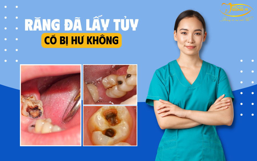 rang-da-lay-tuy-co-bi-hu-khong