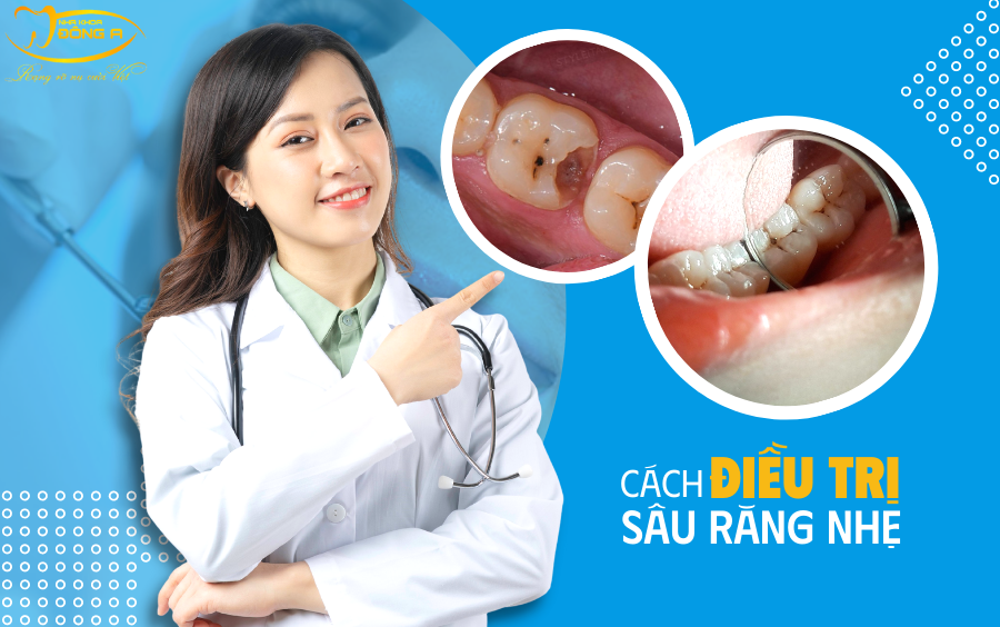 cach-dieu-tri