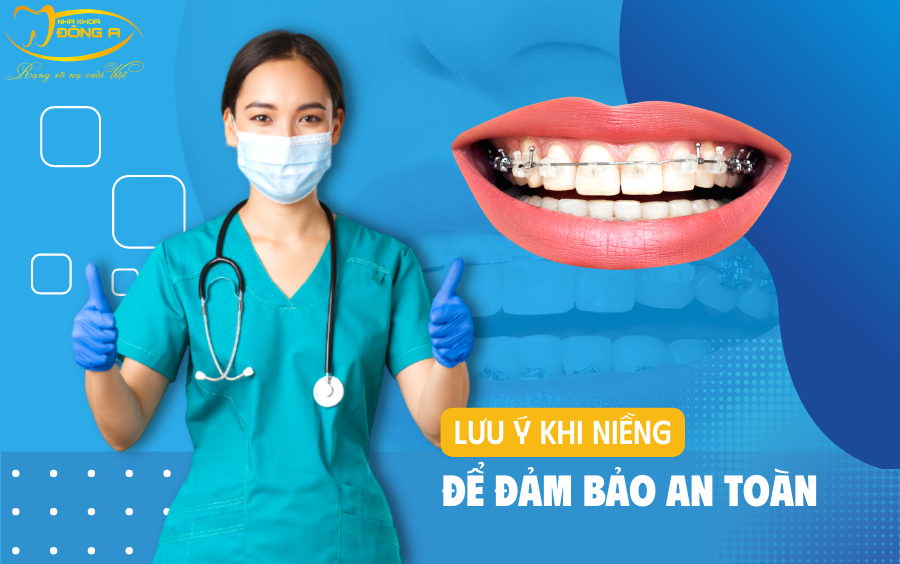 luu-y-khi-nieng-rang