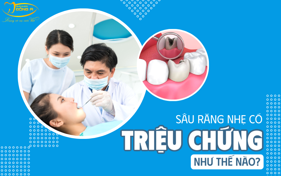 sau-rang-nhe