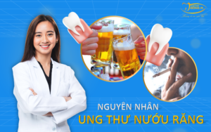 nguyen-nhan-dan-den-ung-thu-nuou-rang