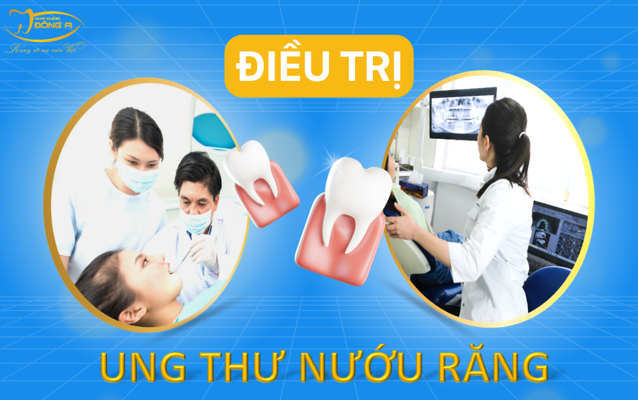 phuong-phap-dieu-tri