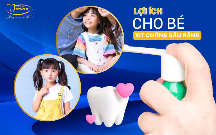 Lợi ích xịt chống sâu răng cho bé