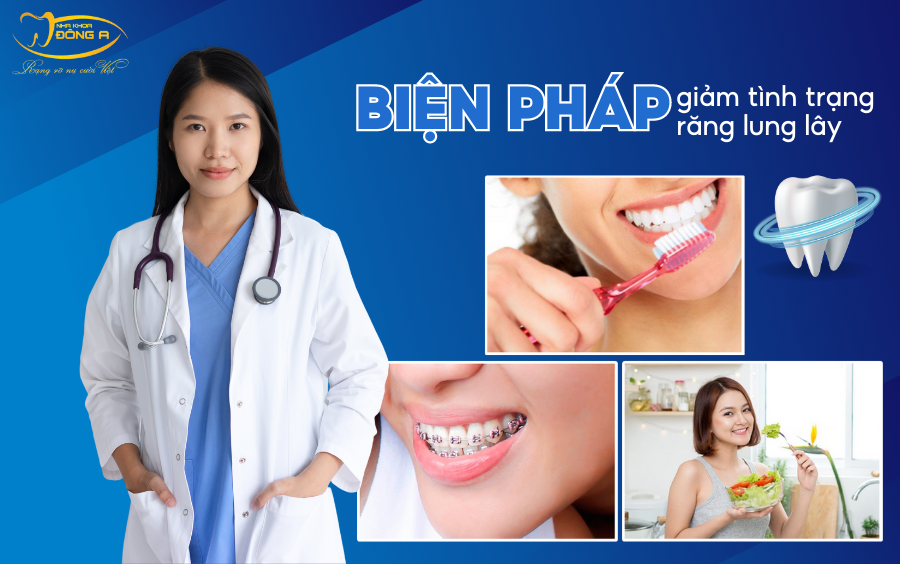 bien-phap