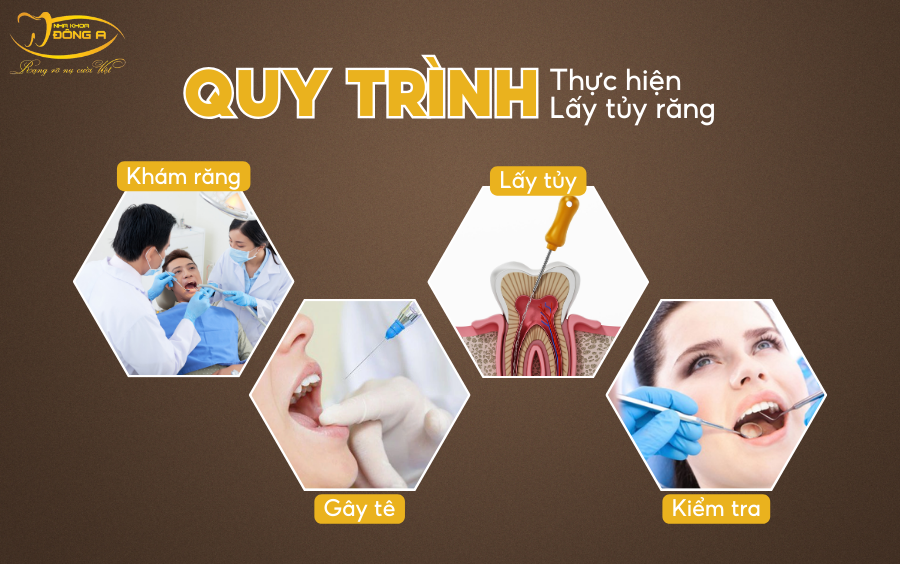 lay-tuy-rang-la-gi