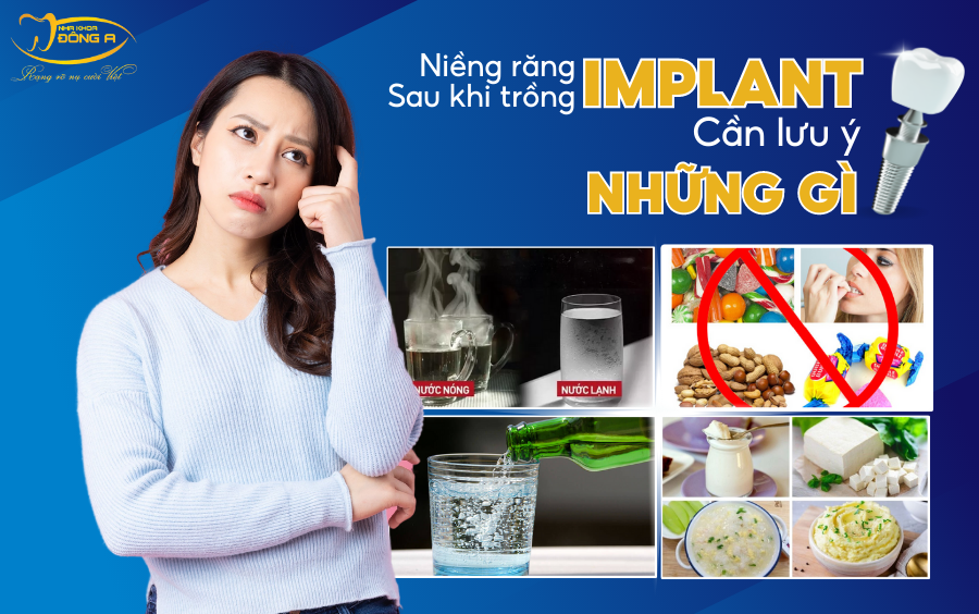 Niềng răng sau khi trồng Implant cần lưu ý những gì?