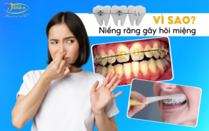 vi-sao-nieng-rang-bi-hoi-mieng