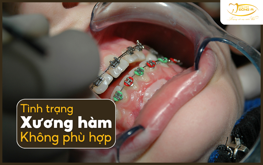 rang-lung-lay