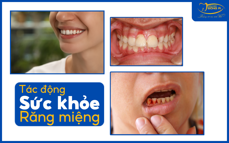 rang-lung-lay