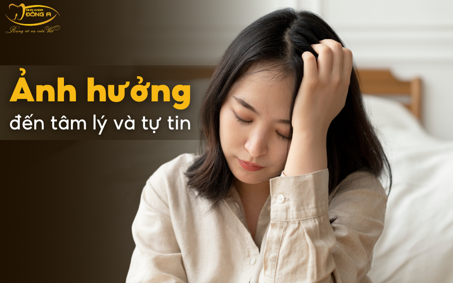 mat-rang-cua