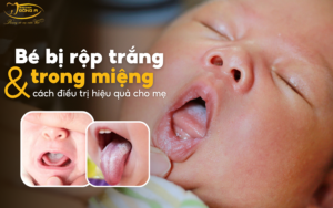 rop-trang-trong-mieng