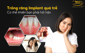trong-rang-implant-qua-tre