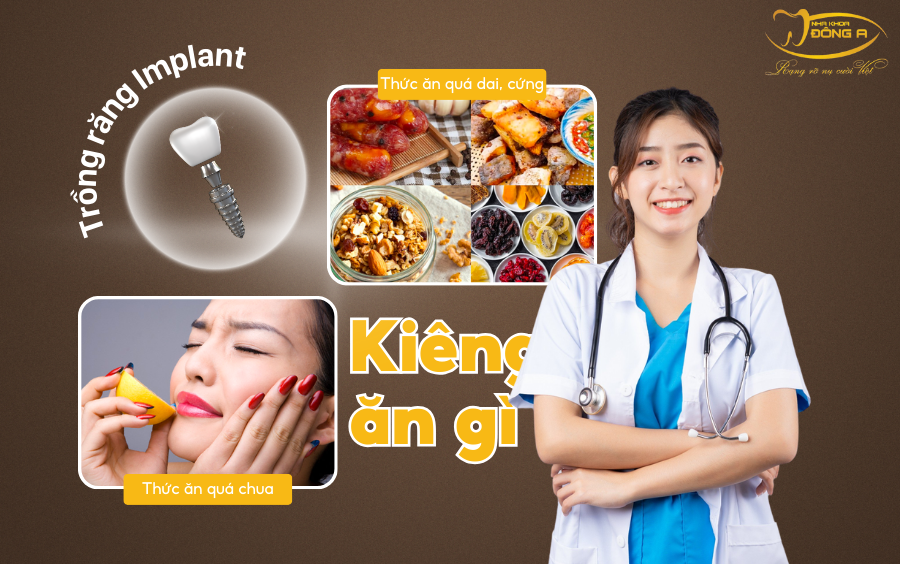 trong-rang-implant